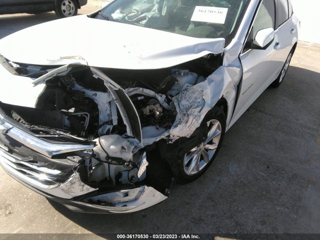 Chevrolet MALIBU LT 2022 1G1ZD5ST5NF104433 Image 6