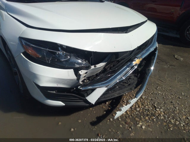 Chevrolet MALIBU LT 2021 1G1ZD5ST1MF075981 Image 6