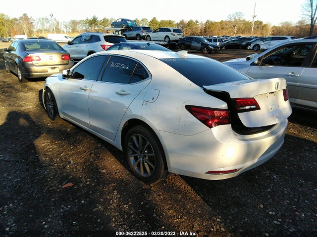 Acura Tlx W/technology Pkg 2017 19UUB1F54HA002295 Image 3
