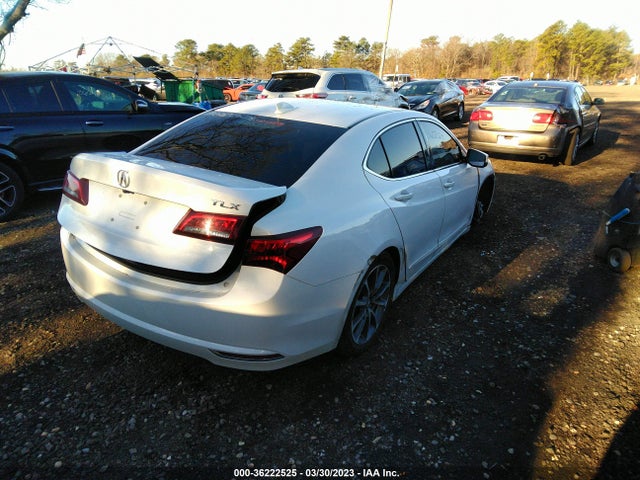 Acura Tlx W/technology Pkg 2017 19UUB1F54HA002295 Image 4
