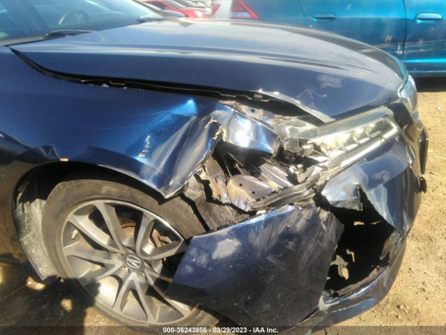 19UUB2F51FA007313 Acura Tlx V6 Tech