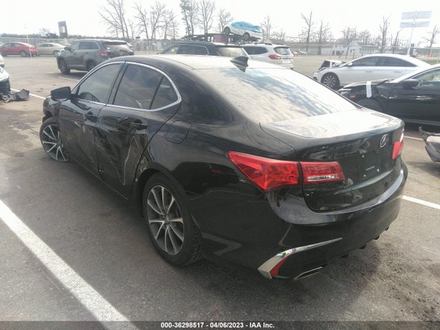 Acura TLX 2018 19UUB2F37JA008330 Image 3
