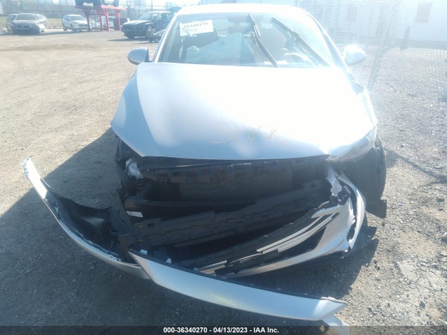 Hyundai ELANTRA SE 2017 5NPD84LF2HH162129 Image 7