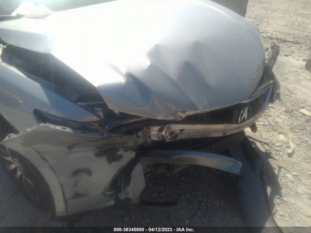 Acura TLX 2015 19UUB1F3XFA029674 Image 6