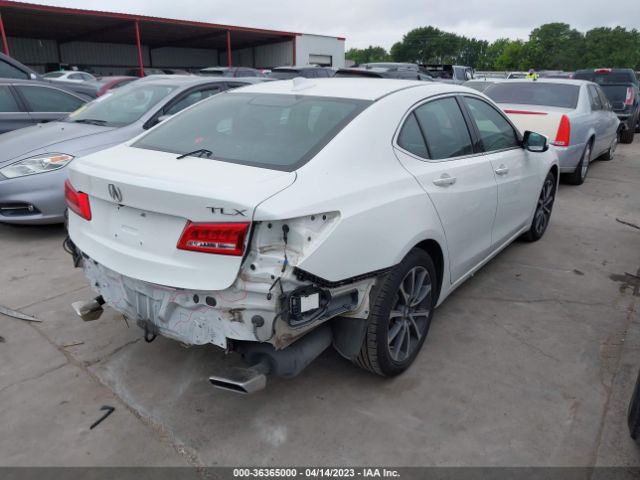 19UUB2F56JA001550 Acura Tlx W/technology Pkg