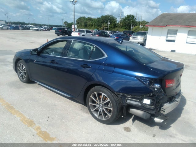 Acura Tlx W/technology Pkg 2018 19UUB2F57JA007177 Image 3
