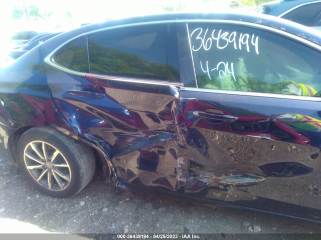 Acura TLX 2019 19UUB1F38KA008297 Image 6