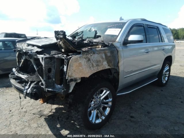 1GKS2BKC0HR151034 GMC YUKON SLT