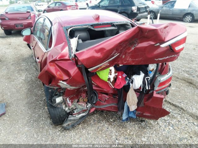 1G4PS5SK1F4177285 Buick Verano Leather Group
