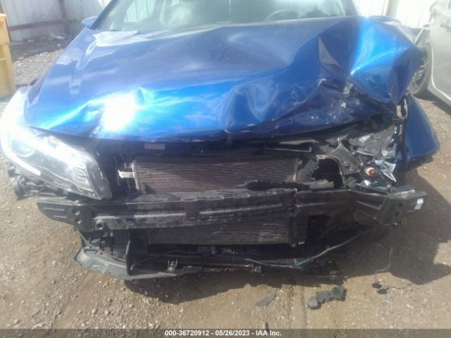 3KPFK4A75HE079286 KIA FORTE LX