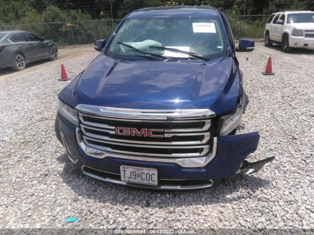 1GKKNKL42PZ113317 GMC ACADIA SLE
