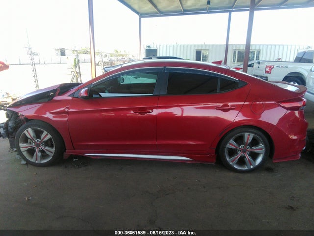 Hyundai ELANTRA SE 2017 5NPD84LF7HH188600 Image 7