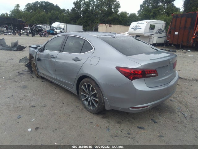 Acura Tlx V6 W/technology Pkg 2017 19UUB2F57HA000398 Image 3