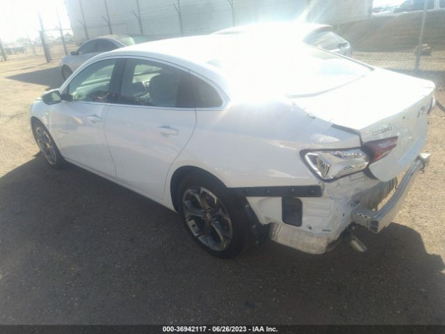 Chevrolet MALIBU LT 2022 1G1ZD5STONF112763 Image 3
