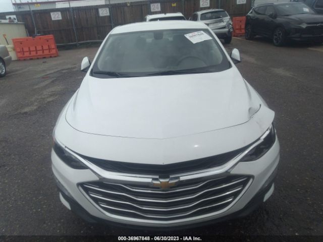 Chevrolet MALIBU LT 2022 1G1ZD5ST8NF108203 Image 5