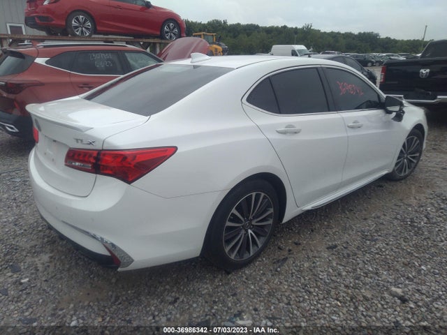 Acura Tlx W/advance Pkg 2018 19UUB2F79JA001415 Image 4