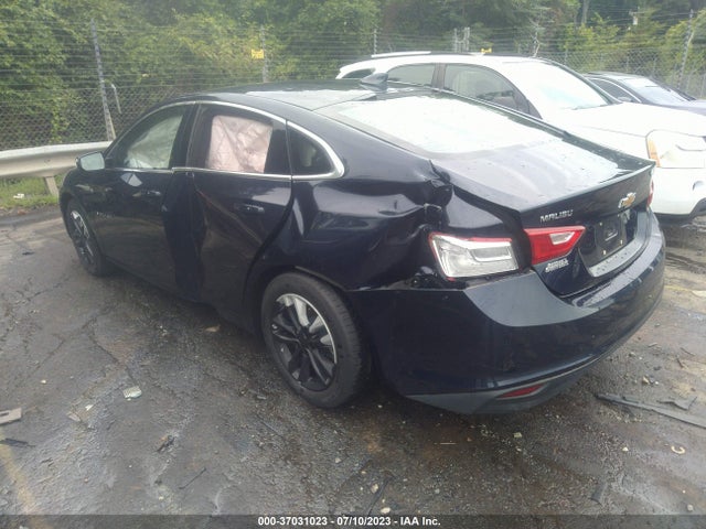 Chevrolet MALIBU LT 2016 1G1ZE5ST7GF244094 Image 3
