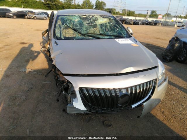 2G4GK5EXXG9177985 Buick Regal