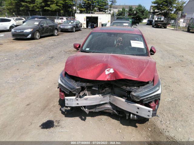 19UDE2F77LA001620 Acura Ilx Pkg