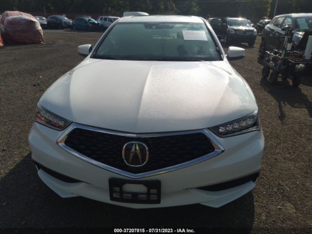 19UUB3F46LA003931 Acura Tlx W/technology Pkg
