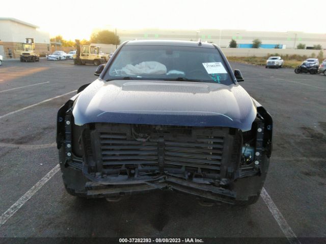 1GKS1FKC6HR202420 GMC Yukon Xl Sle