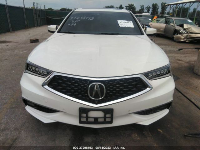 19UUB2F75JA000794 Acura Tlx W/advance Pkg