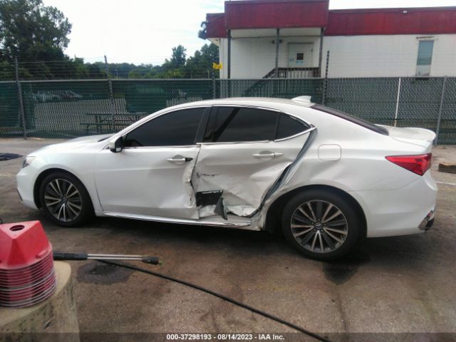 19UUB2F75JA000794 Acura Tlx W/advance Pkg