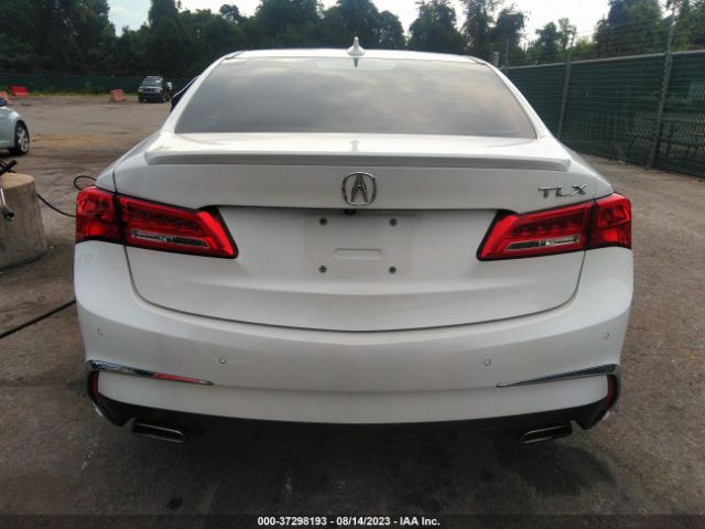 19UUB2F75JA000794 Acura Tlx W/advance Pkg