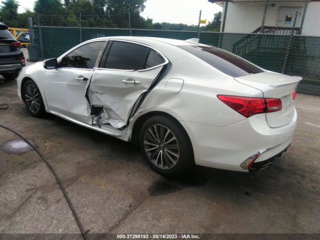 19UUB2F75JA000794 Acura Tlx W/advance Pkg