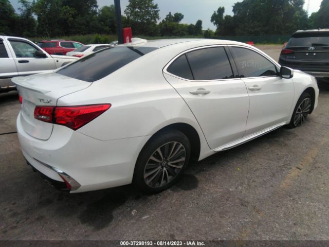 19UUB2F75JA000794 Acura Tlx W/advance Pkg