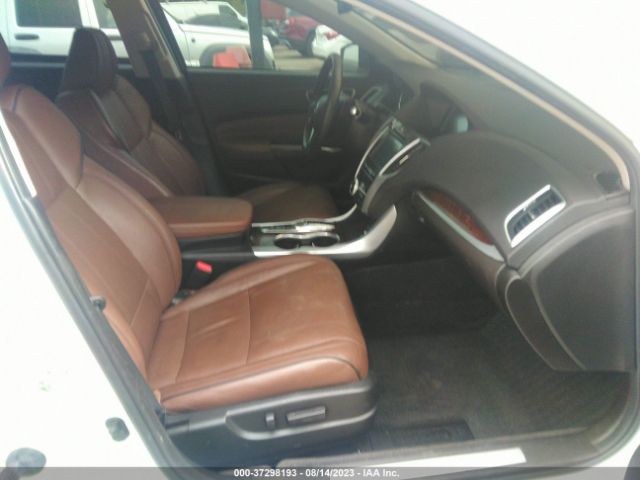 19UUB2F75JA000794 Acura Tlx W/advance Pkg