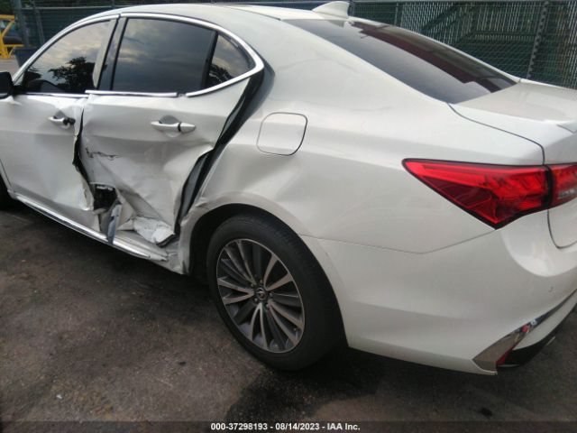 19UUB2F75JA000794 Acura Tlx W/advance Pkg