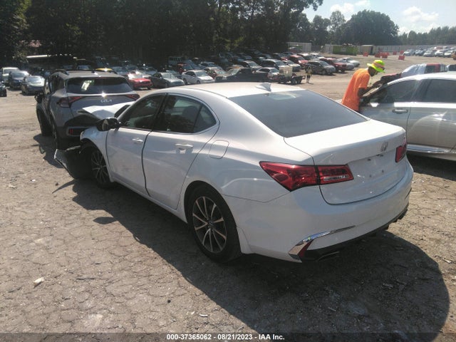 Acura TLX 2018 19UUB2F33JA006994 Image 3