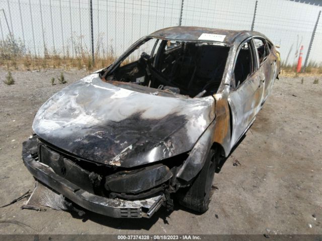 19XFC2F56JE204858 Honda Civic Sedan Lx