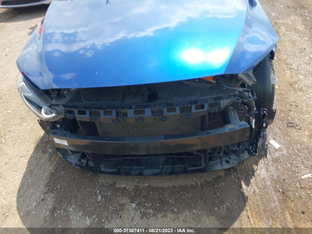 Hyundai ELANTRA SE 2017 5NPD84LF2HH183823 Image 5