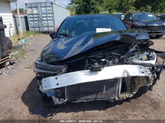 19UDE2F85MA006745 Acura Ilx Package