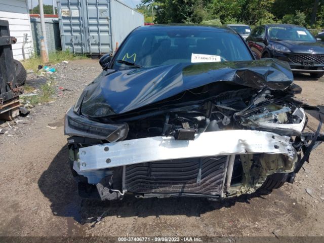 19UDE2F85MA006745 Acura Ilx Package