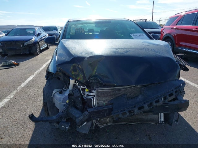 Hyundai ELANTRA SE 2017 5NPD84LF0HH078150 Image 4