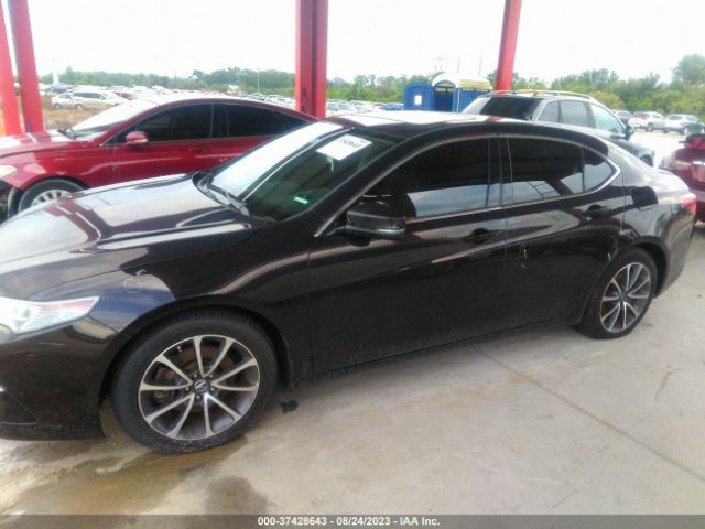 19UUB2F5XFA023476 Acura Tlx V6 Tech