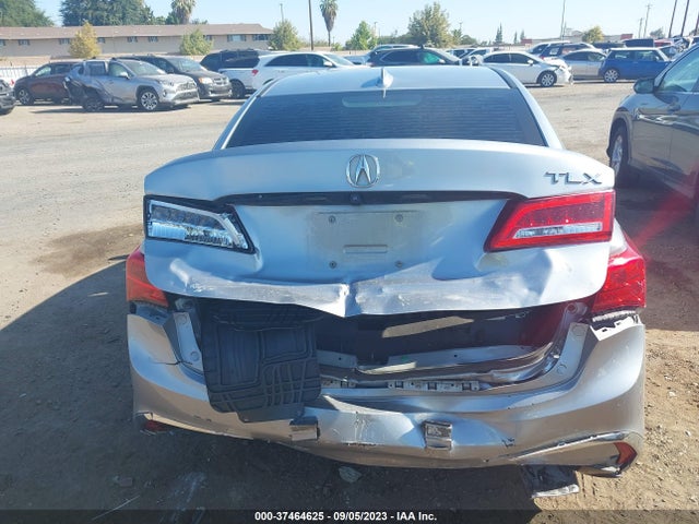 Acura TLX 2019 19UUB2F39KA004782 Image 17