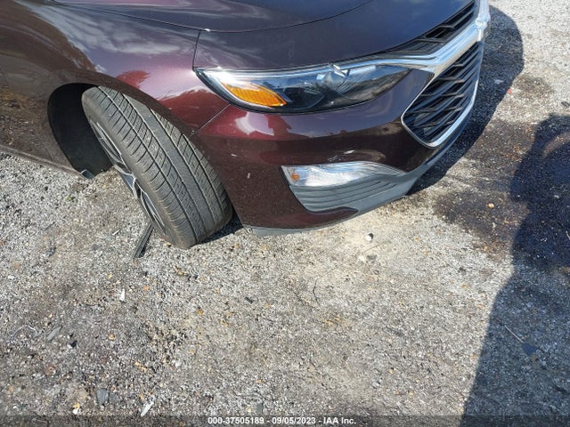 Chevrolet MALIBU RS 2020 1G1ZG5ST2LF060167 Image 6