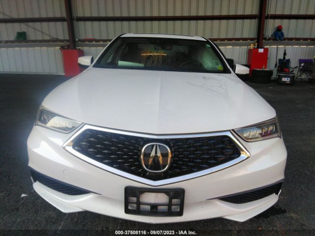 19UUB3F42KA001821 Acura Tlx W/technology Pkg