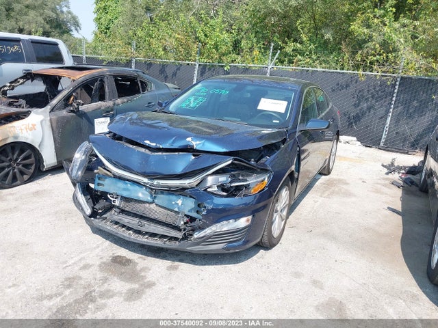Chevrolet MALIBU LT 2022 1G1ZD5ST6NF152281 Image 2