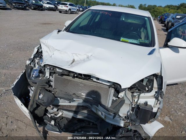 1G4PP5SK2G4136635 Buick Verano