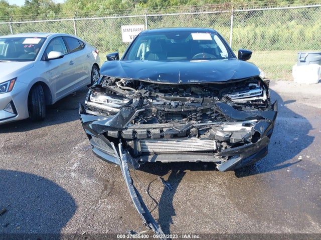 Acura Tlx W/advance Package 2021 19UUB5F66MA016161 Image 12