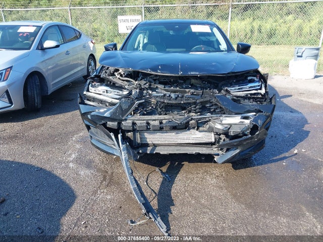 Acura Tlx W/advance Package 2021 19UUB5F66MA016161 Image 6