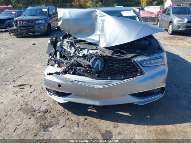 19UUB3F70JA006430 Acura Tlx W/advance Pkg