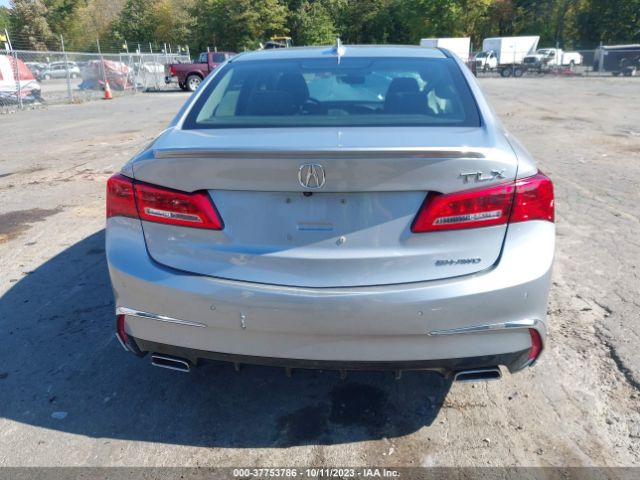 19UUB3F70JA006430 Acura Tlx W/advance Pkg