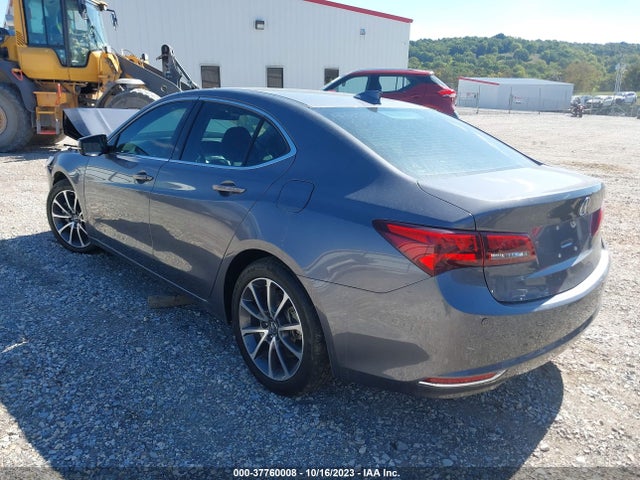Acura Tlx W/advance Package 2017 19UUB2F75HA003317 Image 3