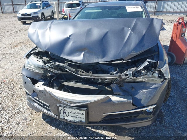Acura Tlx W/advance Package 2017 19UUB2F75HA003317 Image 6